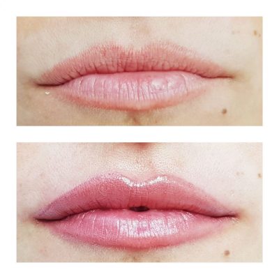 palm lips